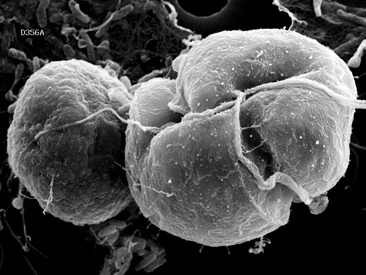 Karenia is a genus that consists of unicellular, photosynthetic, planktonic organisms.